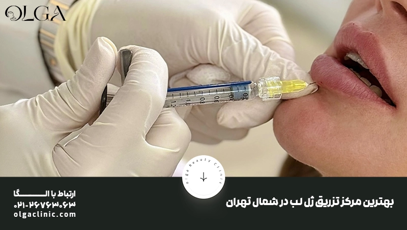 رفع کبودی لب بعد از تزریق ژل در یک روز